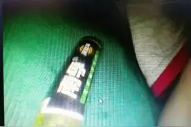3岁男童误吞7号电池，宝妈注意别让宝宝接触小物件图片
