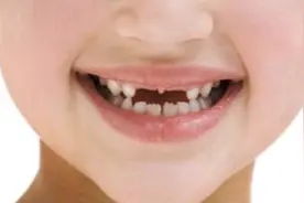 孩子几岁换牙最正常，孩子换牙时出现这种情况要就医检查视频封面