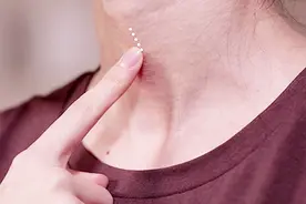 治疗咽喉肿痛，请为颈前部位刮痧~视频封面