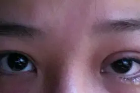 为什么睡觉起来眼睛会浮肿？浮肿又该怎么消除？赶紧收藏~图片