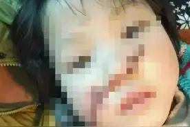 10岁女孩模仿光头强拿电锯割妹妹，妹妹几近毁容。。。图片