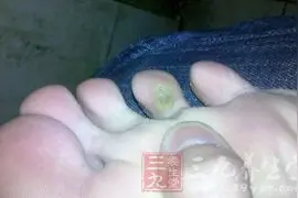 关于脚的事情，你知道多少？图片