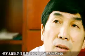 谨记：脸上出现这三种症状，说明你心脏出问题了，赶快治疗视频封面