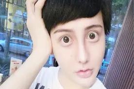 蛇精男刘梓晨晒朋友圈又整容了，全脸打了10几针，这次终于变帅了视频封面