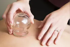 拔火罐的技巧有哪些 拔火罐有什么必知技巧图片