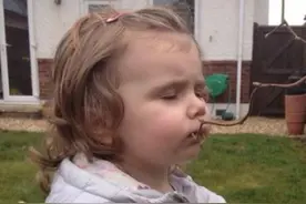 英国3岁女童患异食癖 爱吃石头树枝洗衣粉图片
