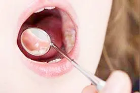 嘴里老长水泡，结果是因为这3个原因视频封面