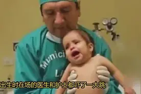 秘鲁女孩患重病酷似美人鱼后代视频封面