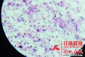 合肥发现罕见布鲁氏菌病例 患者或食用未熟牛羊肉图片