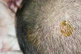 原来这就是头上起疙瘩的原因，你了解了吗？视频封面
