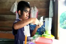 印尼少年患狼人综合症 从头到脚长满黑发视频封面
