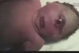 实拍：刚出生的畸形单眼怪婴，既恐怖又可怜，深夜不要看！视频封面