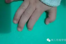 指甲看孩子隐藏的患病信号！赶紧抓着自己和宝宝的手，自测下图片