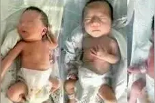 90后妈妈二胎生下三胞胎 2男1女早产儿且肺部都有炎症图片