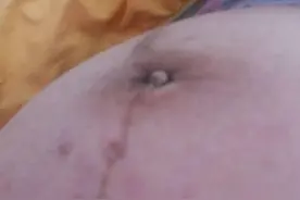 准妈妈掏肚脐竟导致5个月婴儿流产！图片
