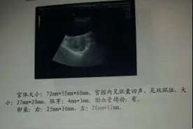 孕妈见褐色液体，诊断先兆流产，婆婆竟不让吃药！图片