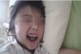 女童睡觉总喜欢睁眼歪嘴，检查结果竟是因为奶奶的一个举动图片