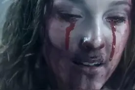 哭的时候流血泪是怎么回事？图片