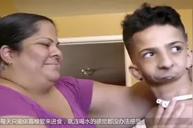 男孩天生无下颚，无法吞咽和说话，却与人配合成为歌手视频封面
