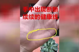 手中健康线断断续续，注定一生身体不健康，病痛多磨视频封面