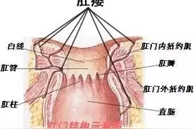 肛瘘的诊断鉴别方法及复发防治图片