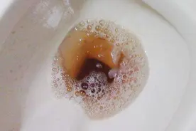 尿液颜色异常必须警惕！这6种颜色赶紧来对号入座！视频封面