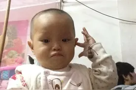 宝宝头发竖着长是缺什么呢？急，有人说是体质不好。不懂求助图片