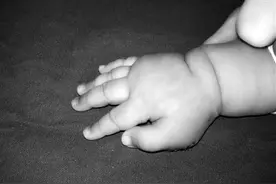 幼子先天六指让绝症患者放心不下，宁波一医院提前实施去指术图片