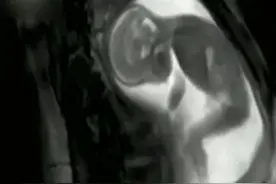 妈妈感受到肚皮上的胎动是这样的，其实宝宝在妈妈肚子里是这样的视频封面