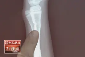无锡一10岁女孩学跆拳道摔碎门牙 如何索赔成难题视频封面