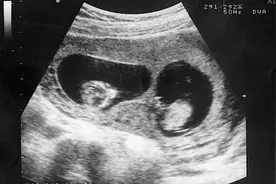 7年不孕好不容易怀上孩子的她，看到宝宝出生后她竟大声的哭了！图片