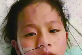 七岁女孩突患再生障碍性贫血图片