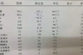 什么是黄疸，黄疸的正常值是多少？视频封面