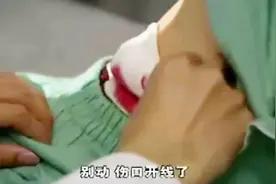 医生割错阑尾，导致病人住了半个月院还没有好，伤口总感染和开线视频封面