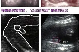 怎么样去判断B超数据看男女图片