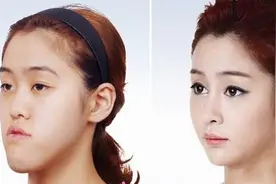 “整容”后过安检，麻烦事儿还真不少！图片