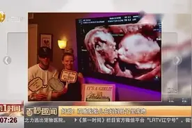 双胞胎胎儿在妈妈肚内亲吻彼此视频封面