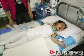 心疼!炎陵三岁女孩全身被烫伤 这些方式可以帮助她图片