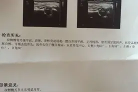 宝宝腿活动有声音怎么回事图片