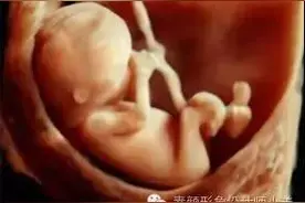 孕育课堂：怀孕六周 胎儿发育与孕妈变化图片