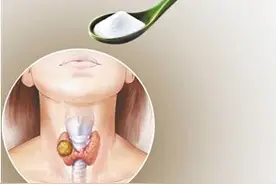 甲状腺疾病怎么预防？碘的合理摄入很关键！图片