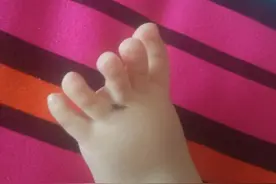 小儿腹胀，推拿三个穴位足矣！图片