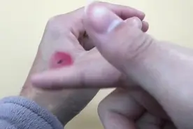 让身上伤口快速愈合很简单，1分钟马上学会，学到就是赚到视频封面