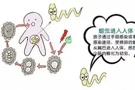 跟我学中医 | 有个宝宝突然抽搐，最后拉出200多条蛔虫图片