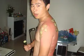 钓鱼被晒各种黑，宝宝心很痛求安慰！图片