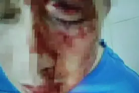 广东一学生家长打老师 致眼眶骨折视频封面