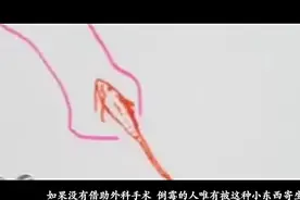 恐怖牙签鱼爱钻男人的尿道夺人命视频封面