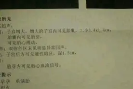 如愿男宝，早期症状褐色分泌孕酮低都不是问题图片