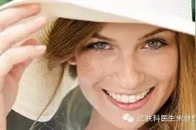 雀斑你长在我脸上，真的好吗？图片