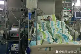 小感冒拖成重症肺炎，壮男靠人工心肺支持6天脱险图片